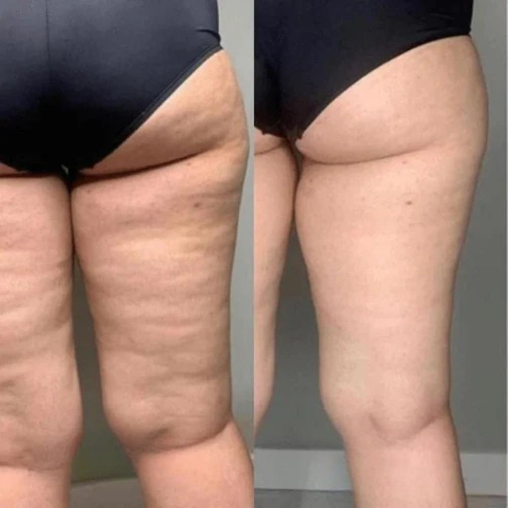 <h2>Vad säger våra kunder?</h2>